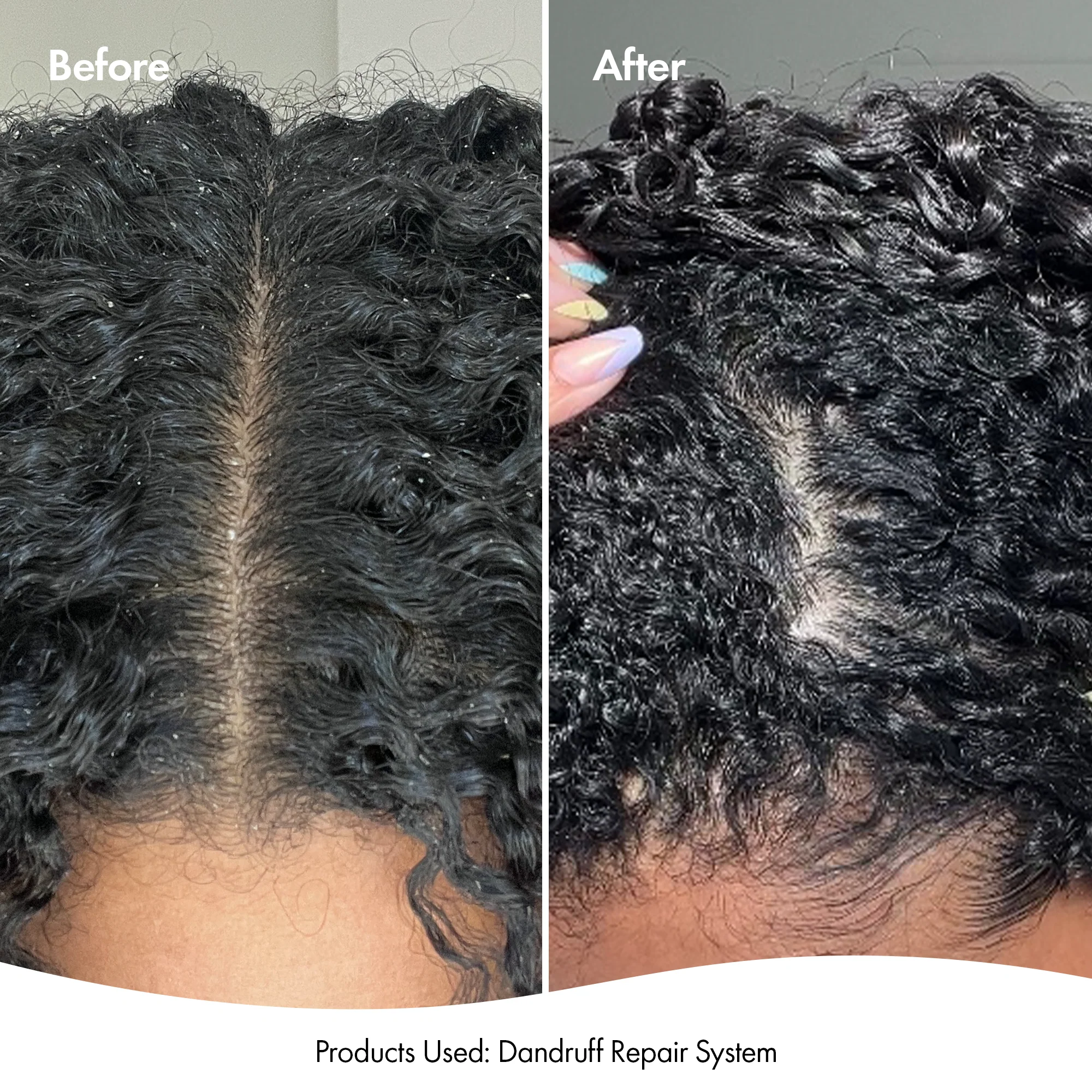 DANDRUFF SHAMPOO & CONDITIONER - Image 3