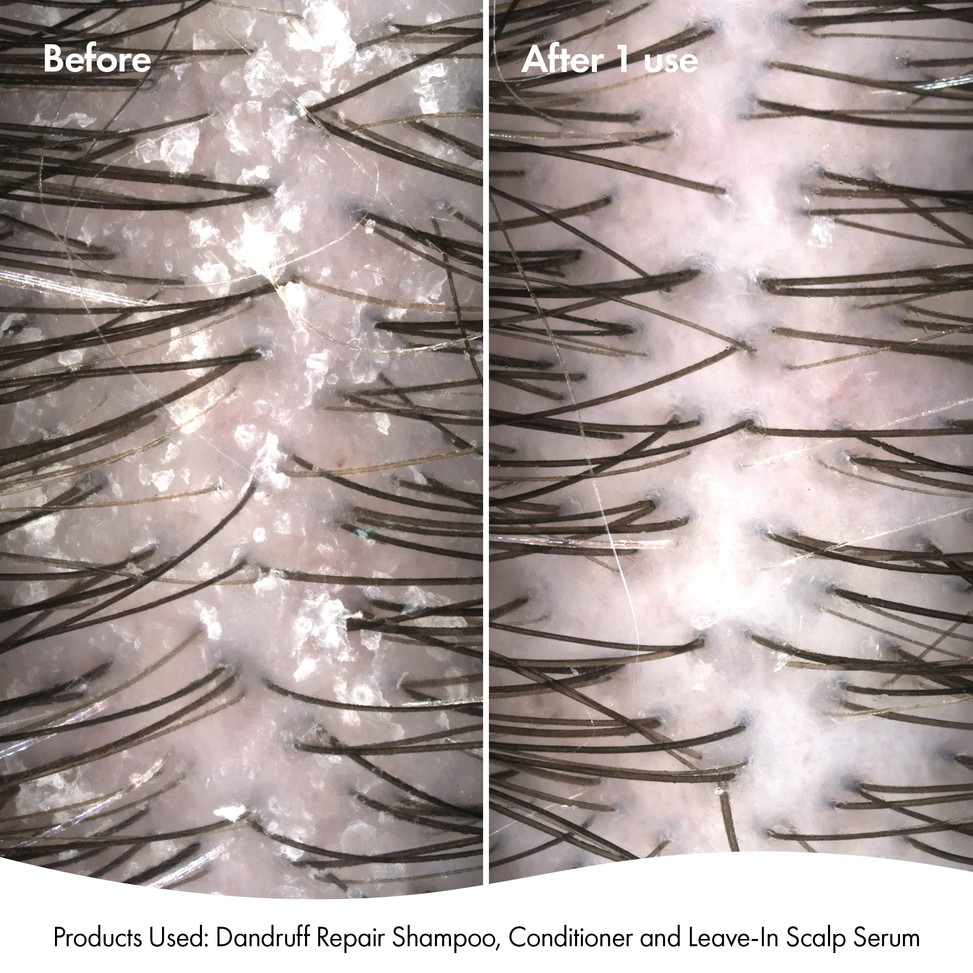 DANDRUFF SHAMPOO & CONDITIONER - Image 4