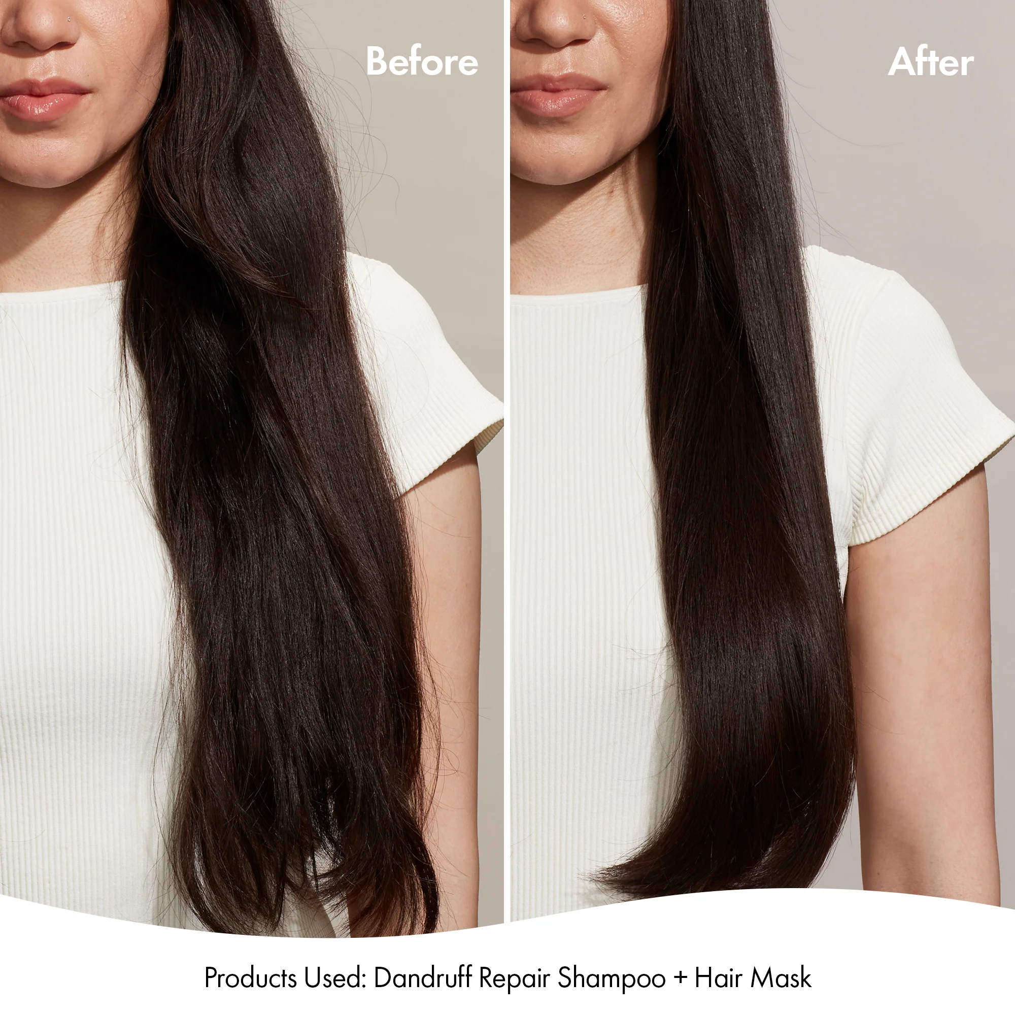 DANDRUFF SHAMPOO - Image 12