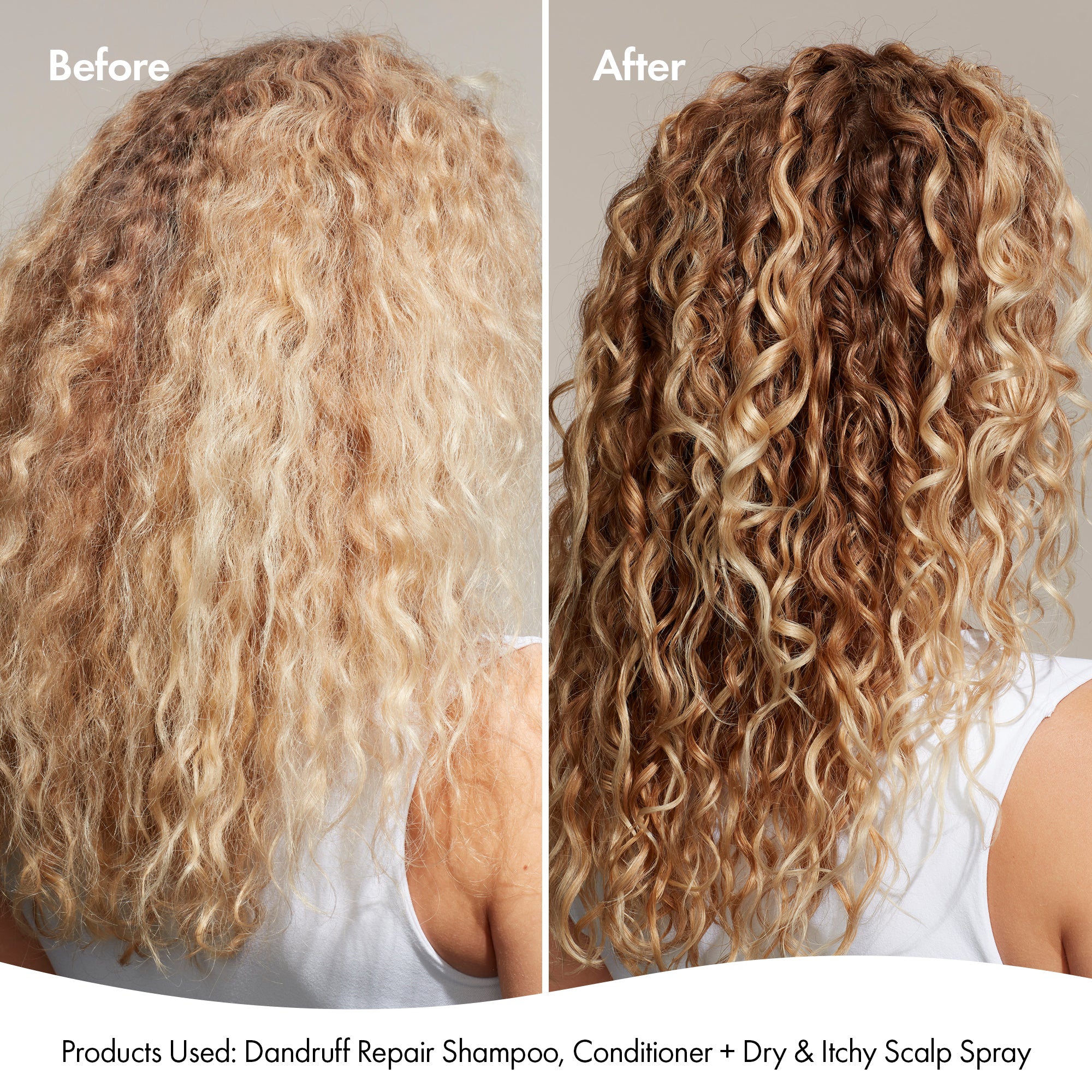 DANDRUFF SHAMPOO - Image 7